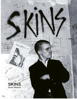 BOOK - SKINS BY GAVIN WATSON (HARDCOVER)