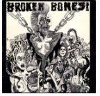 BROKEN BONES - DEM BONES