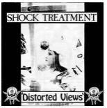 Shock Treatment  Distorted Views